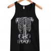 X-Ray tanktop