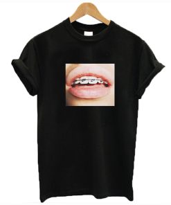 Braces Teeth T-Shirt KM